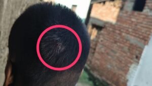 मेला में चल रहे जुआ को लेकर दो पक्षों के बीच हुई मारपीट में करीब आधा दर्जन लोग घायल