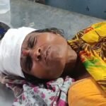 बंदरों के आतंक से ग्रामीणों में दहशत, महिला को छत से धक्का देकर किया घायल, छपरा रेफर