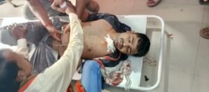 रक्षाबंधन के दिन अलग-अलग तीन सड़क हादसों में चार घायल, दो सदर अस्पताल रेफर