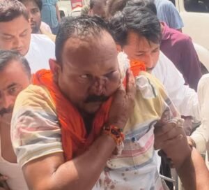 ब्रेकिंग : सिवान  में पूर्व प्रमुख के पति को मारी गोली, गंभीर हालत में पीएमसीएच रेफर  